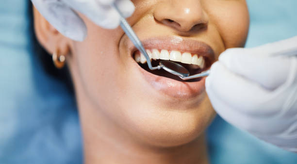 Best Broken or Cracked Tooth Emergency Dentist in Chelsea, MA