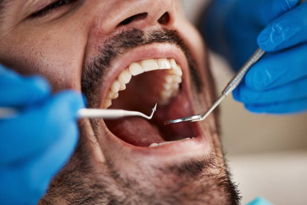 Best Emergency Dental Extractions in Chelsea, MA