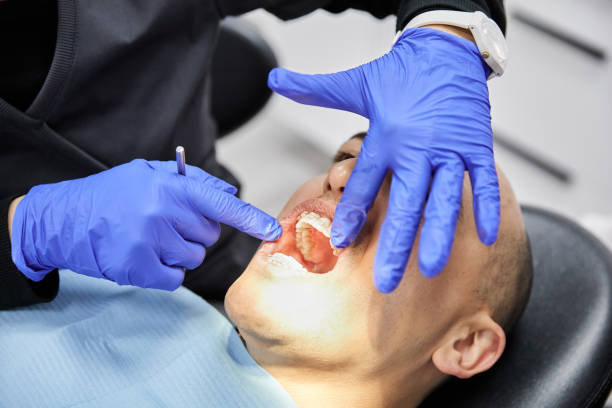 Best Emergency Dental Extractions in Chelsea, MA
